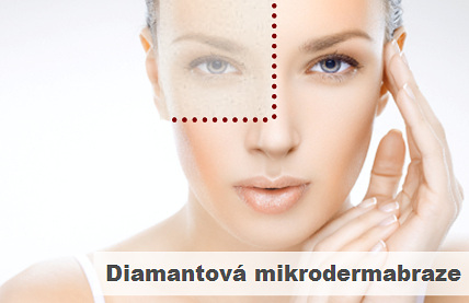 Diamantová mikrodermabraze Praha